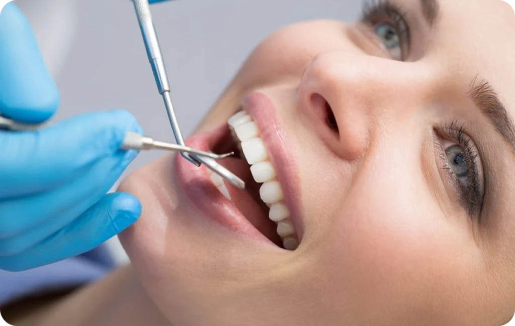 consultation dentaire mesnils sur iton consultation dentaire mesnils sur iton Traitement par érosion-infiltration