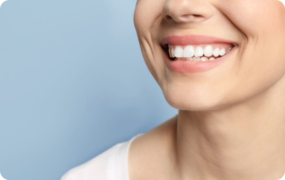 dentiste drs simon gervais Traitement par érosion-infiltration