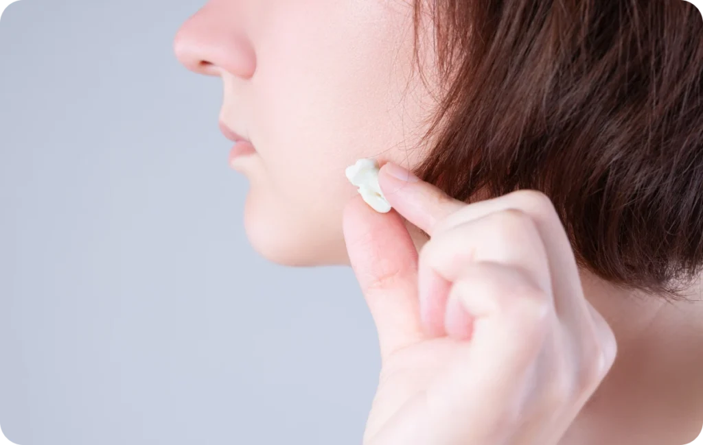 dents sagesse mesnils sur iton dents sagesse mesnils sur iton Chirurgie dentaire