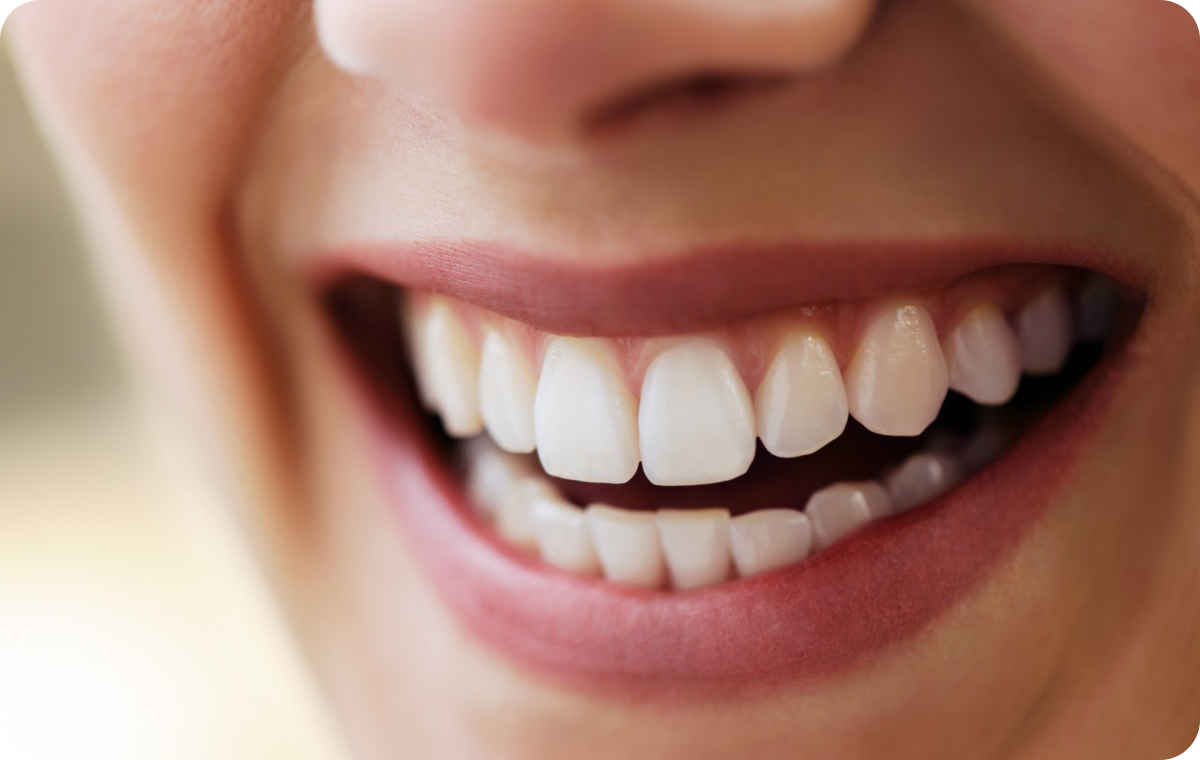 esthetique dentaire mesnils sur iton Occlusodontie