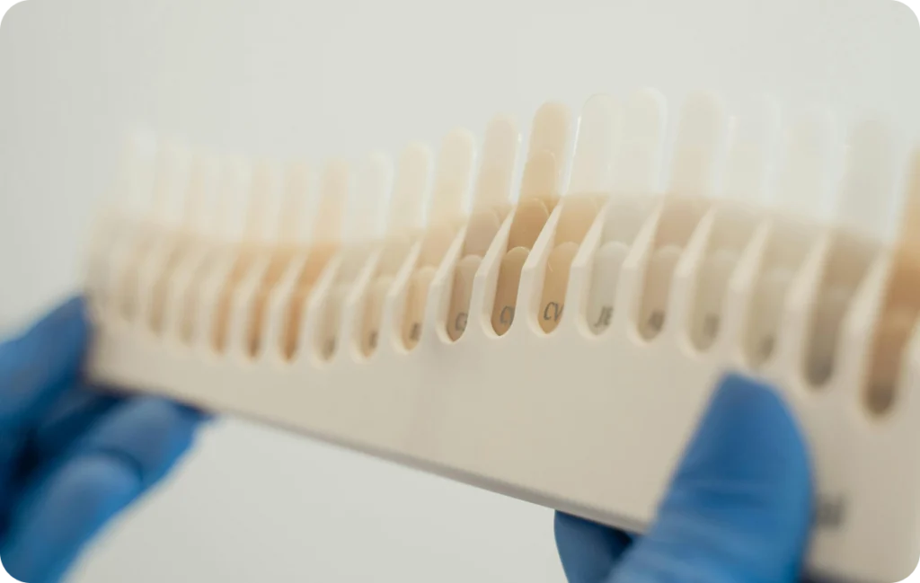 facettes ceramiques mesnil sur iton dr simon facettes ceramiques mesnil sur iton dr simon Facettes