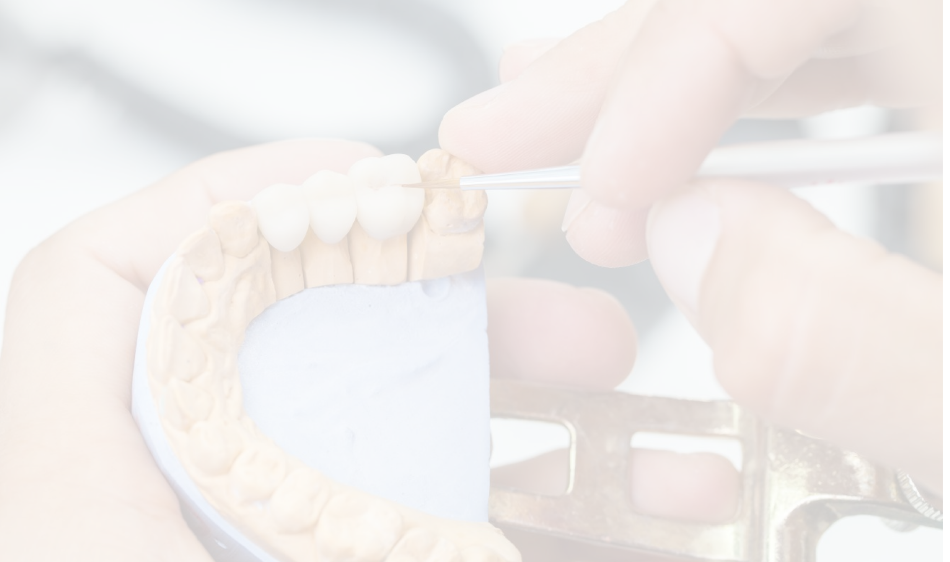 laboratoires protheses dentaires mesnil sur iton Notre Cabinet