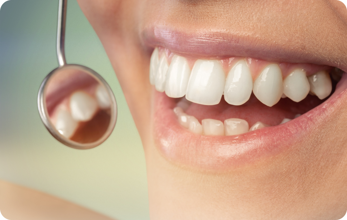 parodontologie medicale mesnil sur iton dr simon Parodontologie médicale