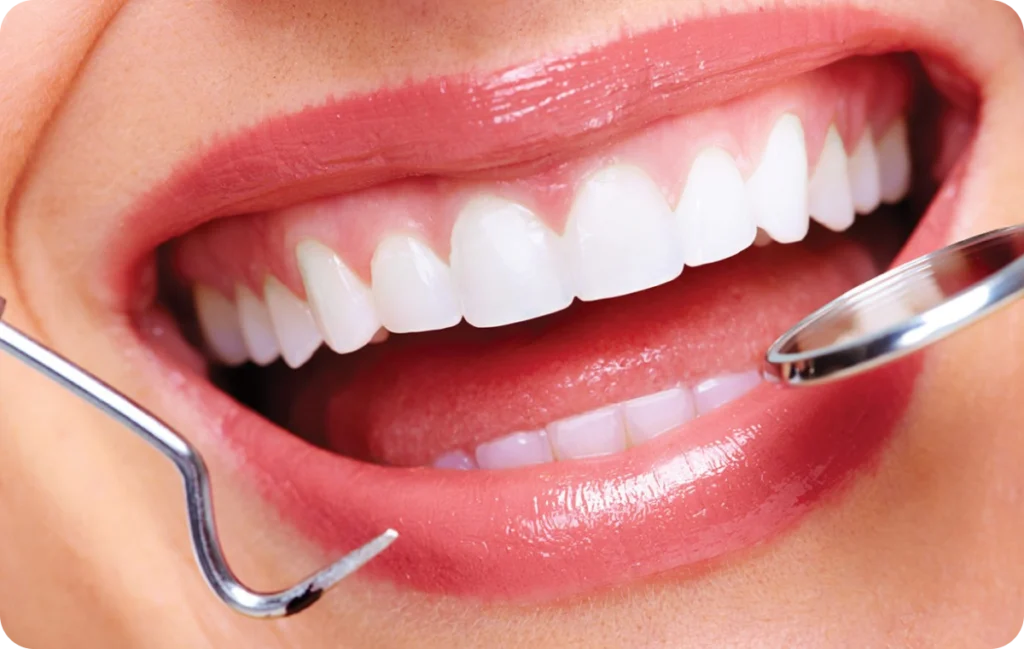 parodontologie mesnil sur iton dr simon parodontologie mesnil sur iton dr simon Nutrition