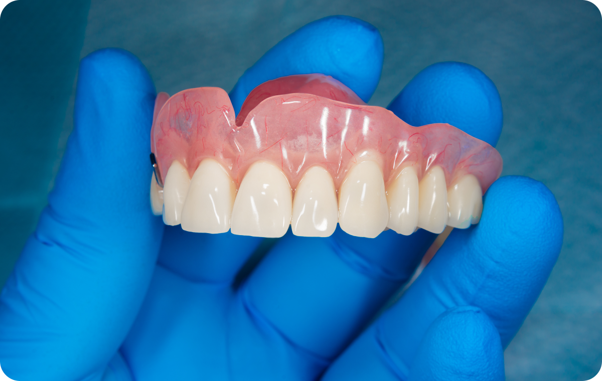 prothese amovible partielle mesnils sur iton Prothèse amovible partielle