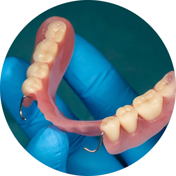 protheses amovibles mesnils sur iton Soins des prothèses amovibles