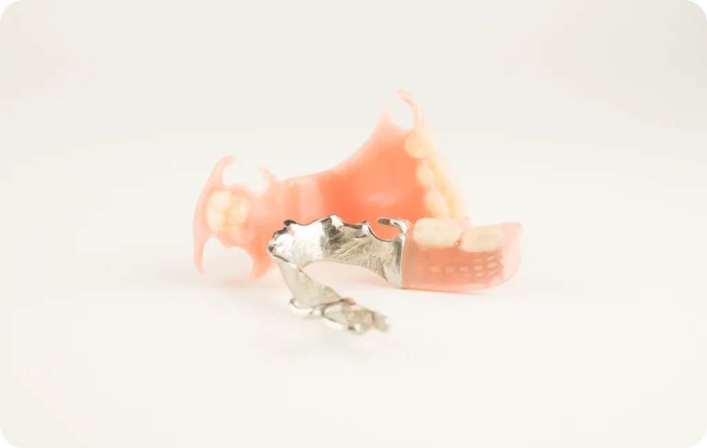 protheses amovibles partielles mesnils sur iton protheses amovibles partielles mesnils sur iton Prothèse amovible partielle