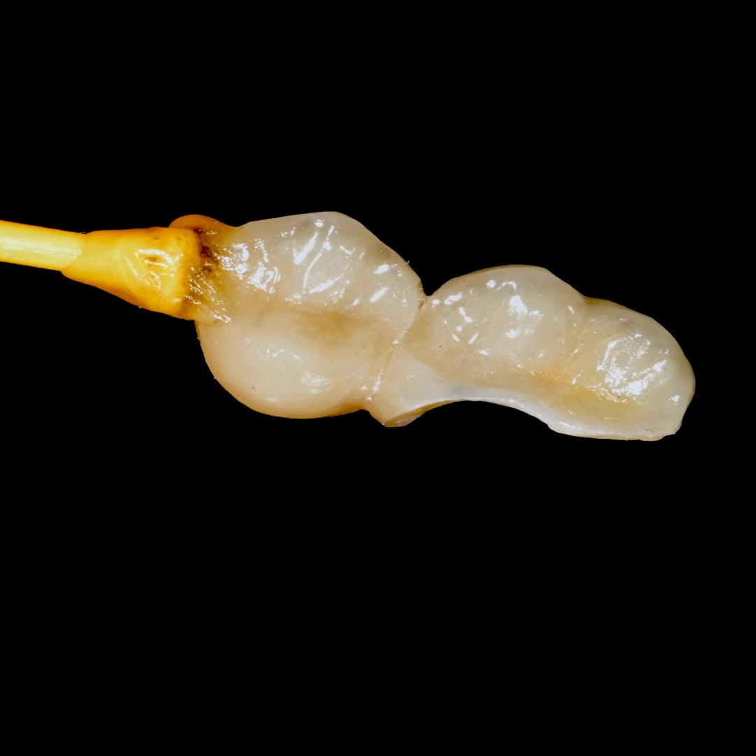 prothese dentaire mesnils sur iton Notre Cabinet